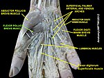 Flexor pollicis brevis muscle