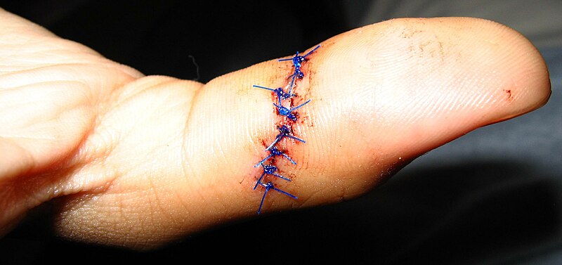 File:Sutures.jpg