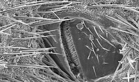 Scanning electron micrograph of a spiracle valve—the organ that allows fresh air to pass into the cricket's respiratory system