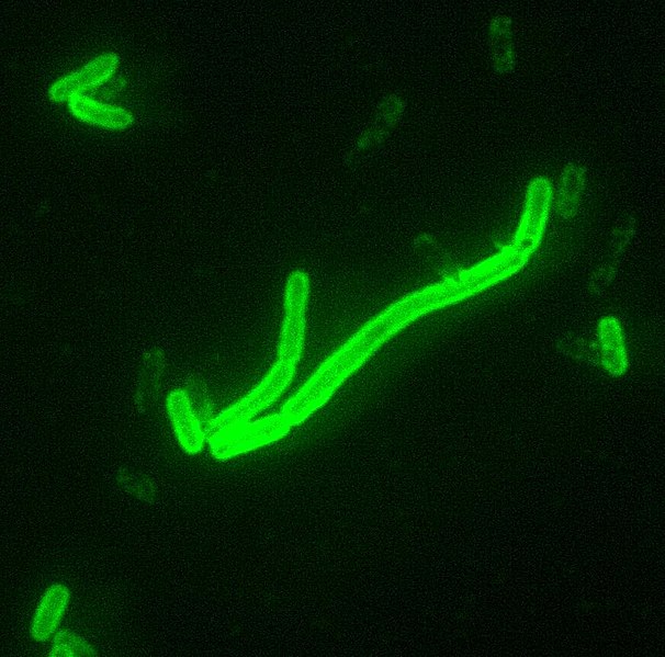 Archivo:Yersinia pestis fluorescent.jpeg