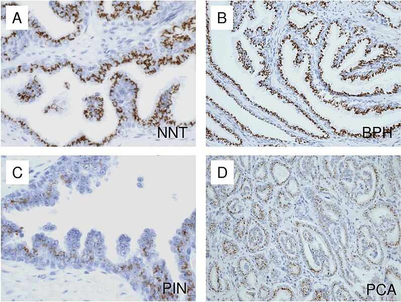 File:Prostate histology.jpg