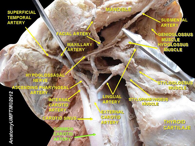 File:Slide11hhh.JPG