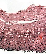 Histological section of the esophageal wall.