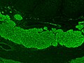 Endomysial Antibodies