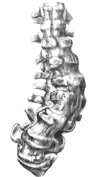 File:Gideon mantell spine1.png