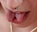 Tongue splitting