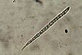 Acicular spore of B. schweinitzii, 65 x 6 micrometres, photographed through a compound microscope, x1000