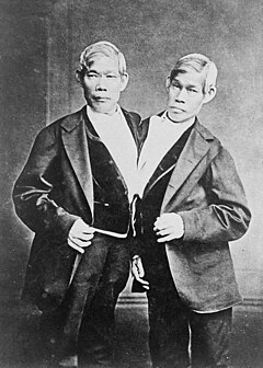 60-ish year old conjoined twin brothers wearing a suit and facing the camera