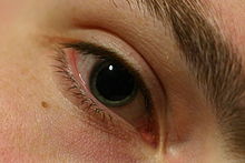 Dilated pupil.gk.jpg