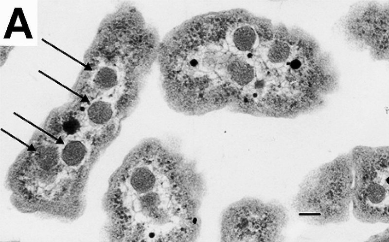 File:Carboxysomes EM ptA.jpg