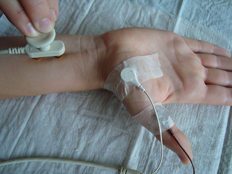 File:Nerve conduction velocity.jpg