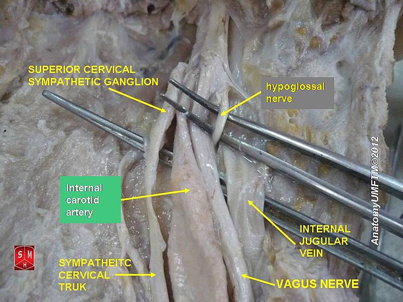 File:Slide3mm.JPG