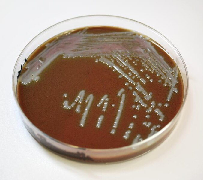 Файл:Chocolate agar 1.jpg