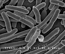 Scanning electron micrograph of Escherichia coli