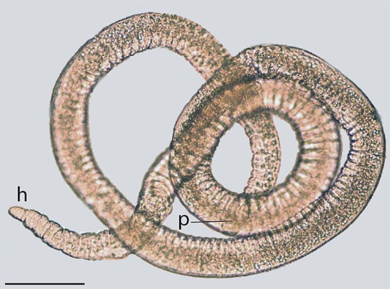 File:Gnathostomulida Filospermoidea.jpg