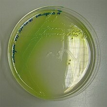 Photograph of a petri dish showing P. aeruginosa with yellow-green Pycocyanin-pigment on cetrimid agar-agar