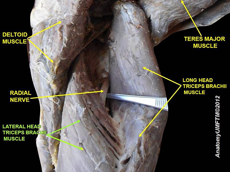 File:Slide5aaaa.JPG