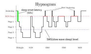 Hypnogram showing sleep cycles from midnight to morning