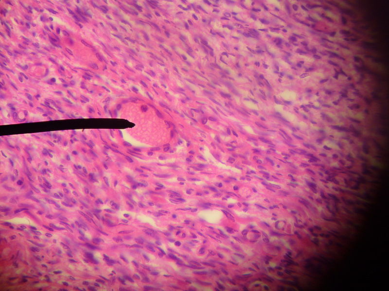 File:Primary follicle (transition).jpg