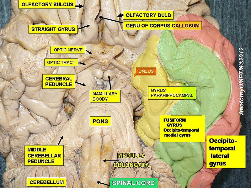 File:Slide12ee.JPG