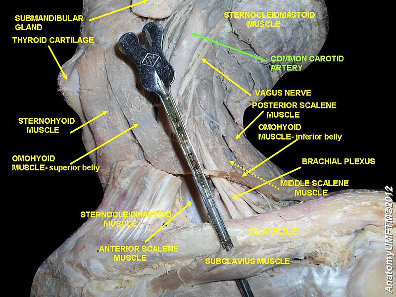 File:Slide14b.JPG