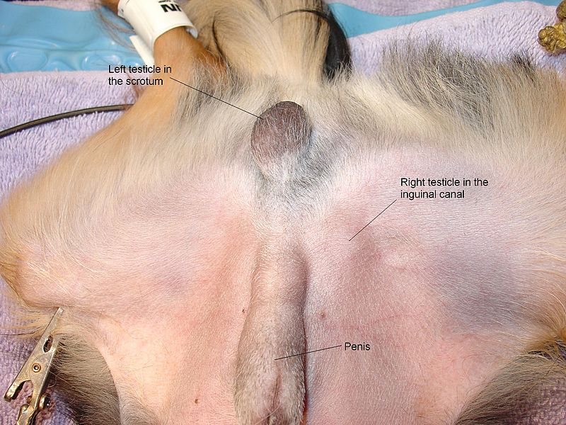 File:Inguinal cryptorchid 1.JPG