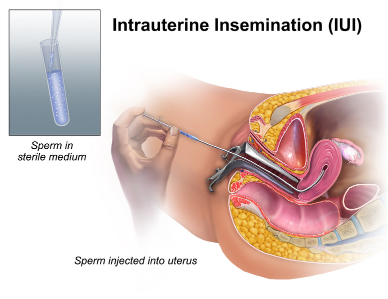 File:IUI.png