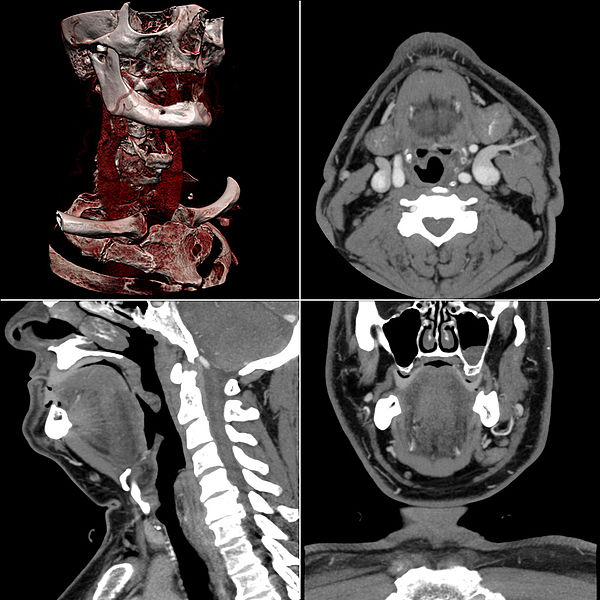 File:Ct-workstation-neck.jpg