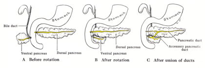 Formation of an accessory pancreatic duct