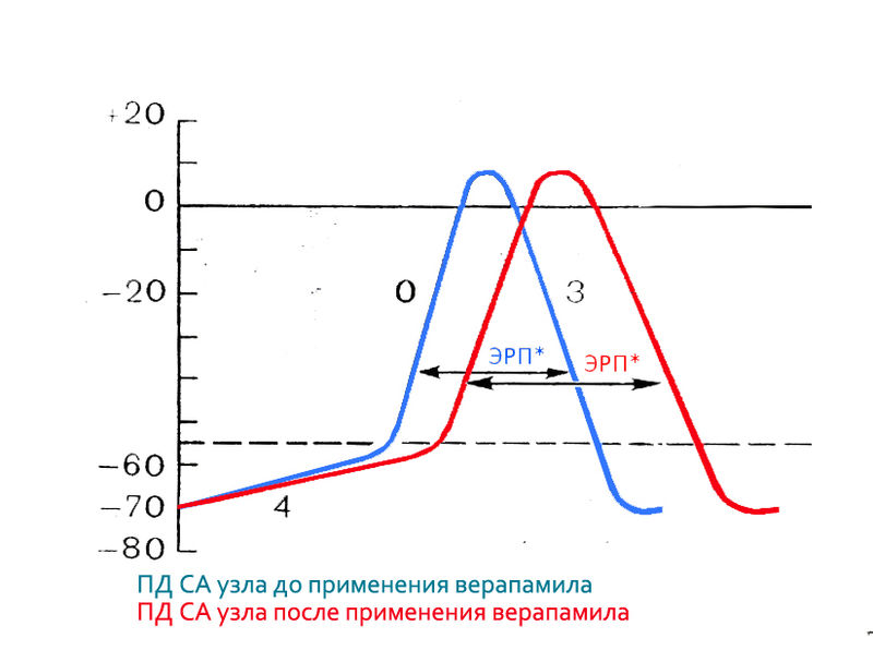 Файл:IV class action.jpg