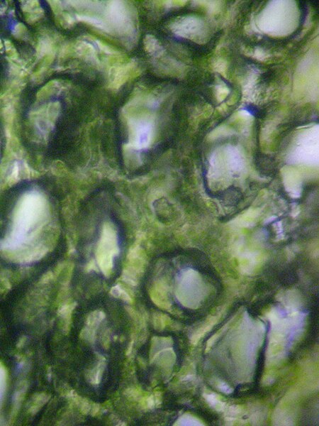 File:Leaf spongy mesophyll.jpg