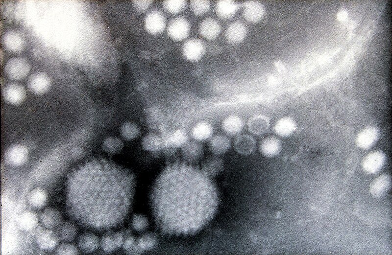 File:AAVs by electron microscopy.jpg