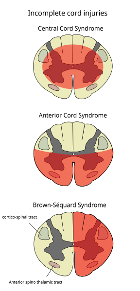 File:Cord s.svg