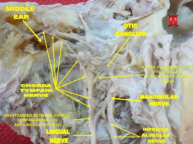 File:Chorda tympani nerve.jpg