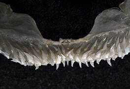 Upper teeth