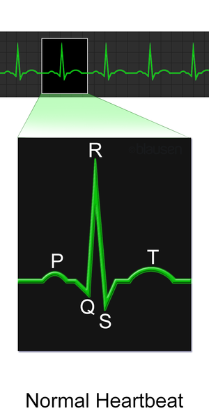 File:Blausen 0465 Heartbeat EKG.png