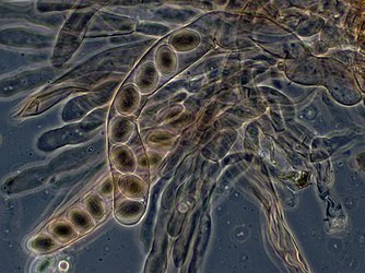 Asci and ascospores