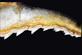 Upper teeth