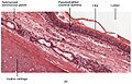 Cross-section of the trachea, with pseudostratified ciliated columnar epithelium and goblet cells labelled