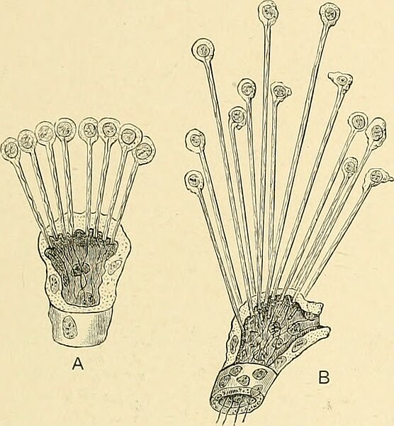 File:Cluster of Solenocytes.jpg