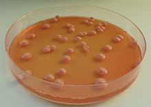 Brettanomyces plate 01.jpg