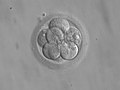 Thumbnail for Embryo transfer