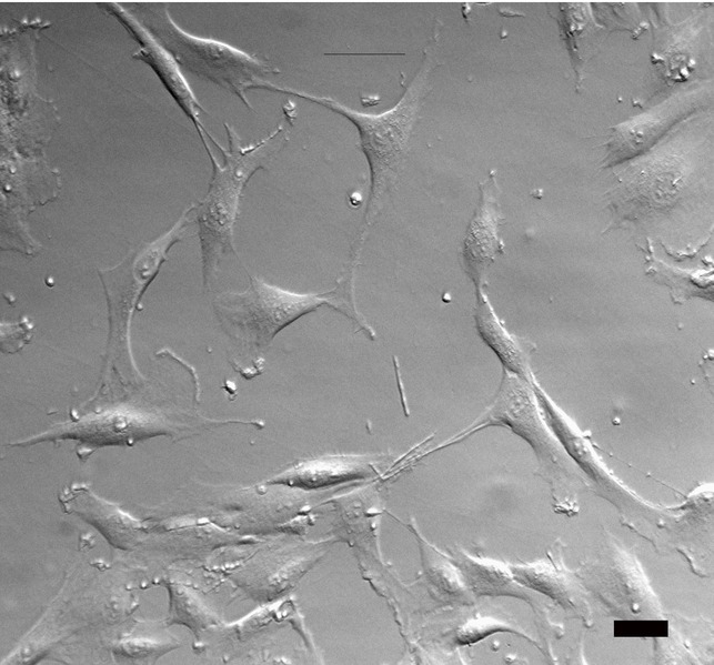 File:Human-meniscus-cells-gruber-et-al-2008.tiff