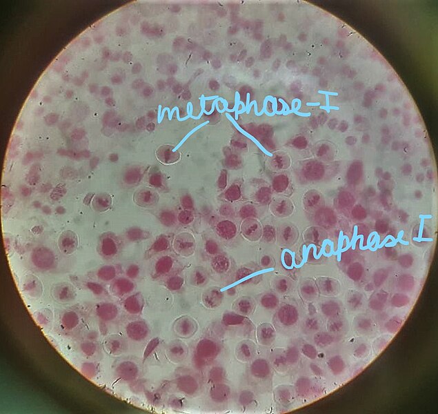 File:Meiosis I.jpg