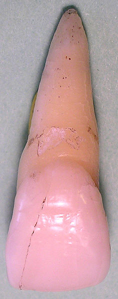 File:Centralincisorfacial06-06-06b.jpg