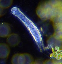 Darkfield photo of a gastrotrich, which form a phylum of worm-like animals living mostly between particles of sediment