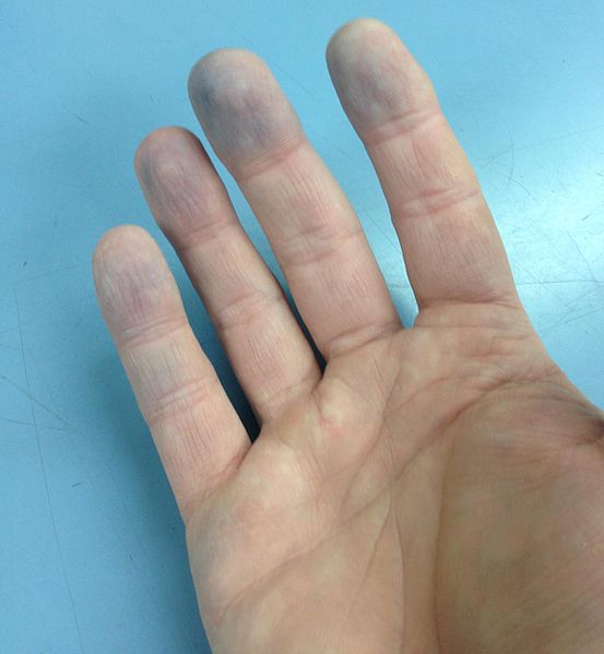 File:Blue finger tips 2.jpg