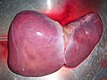 Human Liver taken from Autopsy