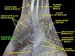 Flexor pollicis brevis muscle