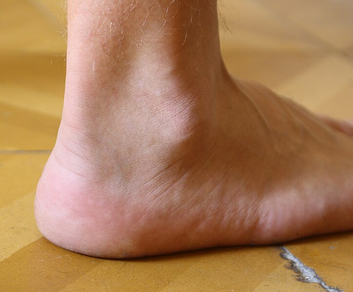 File:Ankle.jpg